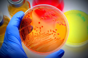 AgarPlateBacteriaCultures